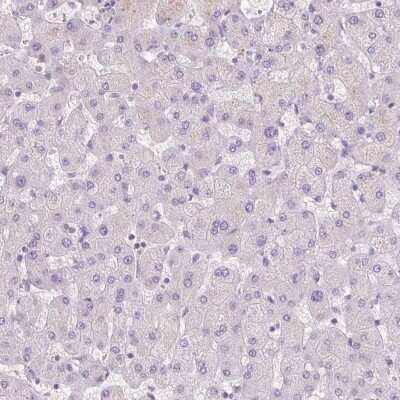 Immunohistochemistry-Paraffin: BPIL1 Antibody [NBP2-14358]