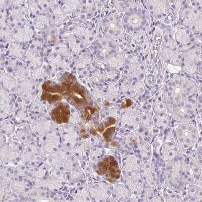 Immunohistochemistry-Paraffin: BPIL1 Antibody [NBP2-14358]