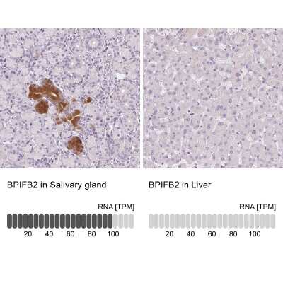 Immunohistochemistry-Paraffin: BPIL1 Antibody [NBP2-14358]