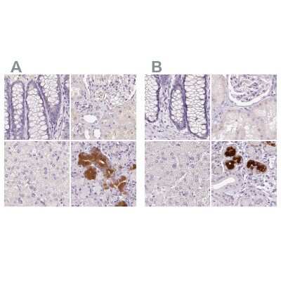 Immunohistochemistry-Paraffin: BPIL1 Antibody [NBP2-14358]