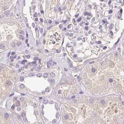 Immunohistochemistry-Paraffin: BPIL1 Antibody [NBP2-14358]