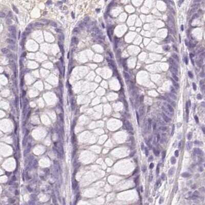 Immunohistochemistry-Paraffin: BPIL1 Antibody [NBP2-14358]