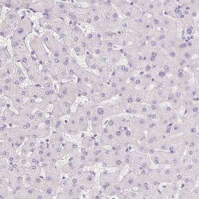 Immunohistochemistry-Paraffin: BPIL1 Antibody [NBP2-38887]