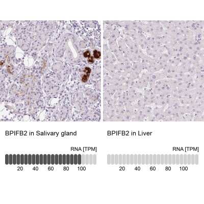 Immunohistochemistry-Paraffin: BPIL1 Antibody [NBP2-38887]