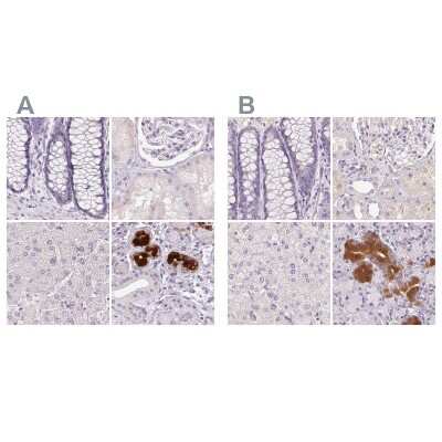 Immunohistochemistry-Paraffin: BPIL1 Antibody [NBP2-38887]