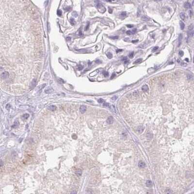 Immunohistochemistry-Paraffin: BPIL1 Antibody [NBP2-38887]