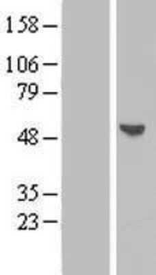 Western Blot: BPIL1 Overexpression Lysate [NBP2-06208]