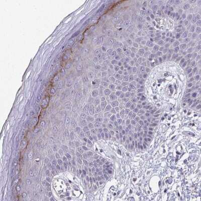 Immunohistochemistry: BPIL2 Antibody [NBP2-38507]