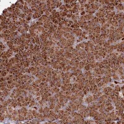 Immunohistochemistry-Paraffin: BPIL2 Antibody [NBP1-90753]