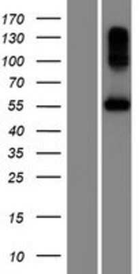 Western Blot: BPIL2 Overexpression Lysate [NBP2-05103]