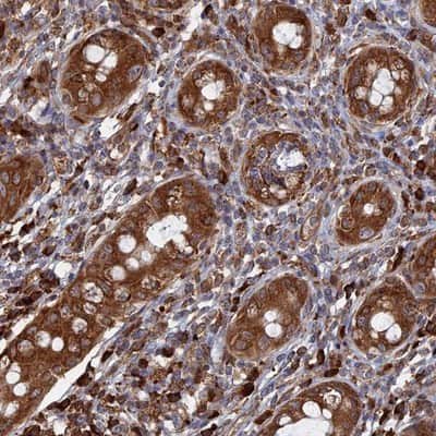 Immunohistochemistry-Paraffin: BPIL3 Antibody [NBP1-88372]
