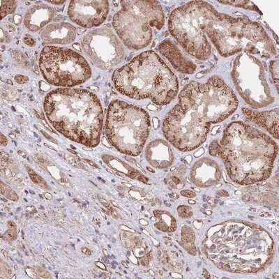 Immunohistochemistry-Paraffin: BPNT1 Antibody [NBP2-14359]