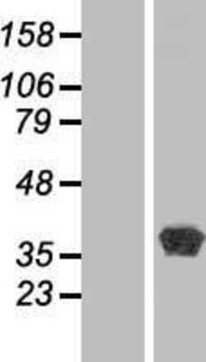 Western Blot: BPNT1 Overexpression Lysate [NBP2-07667]