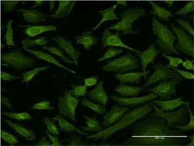 Immunocytochemistry/ Immunofluorescence: BPOZ Antibody (2A10) [H00080325-M02]