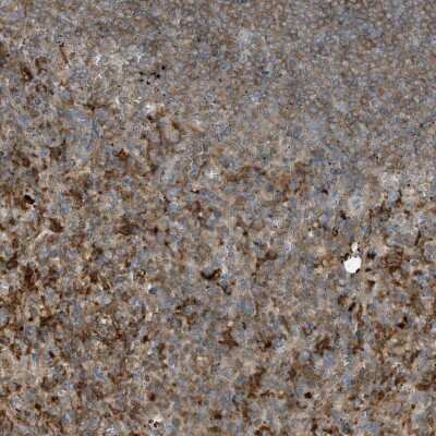 Immunohistochemistry-Paraffin: BPOZ Antibody [NBP1-89944]