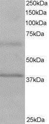 Western Blot: BPOZ Antibody [NB100-836]