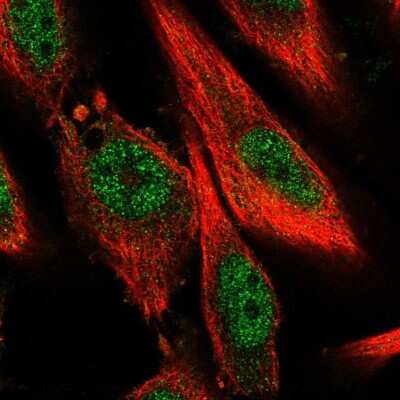 Immunocytochemistry/ Immunofluorescence: BPTF/FALZ Antibody [NBP2-57567]