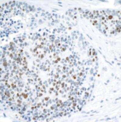 Immunohistochemistry-Paraffin: BPTF/FALZ Antibody [NB100-41418]