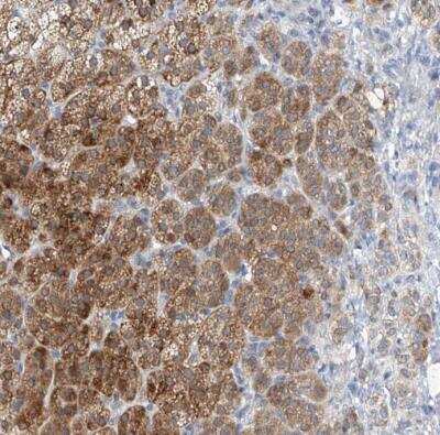 Immunohistochemistry-Paraffin: BPTF/FALZ Antibody [NBP1-84756]