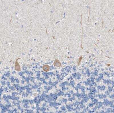 Immunohistochemistry-Paraffin: BPTF/FALZ Antibody [NBP1-84756]