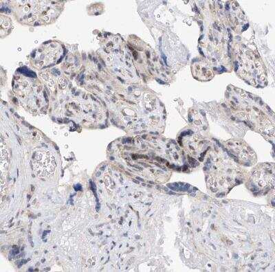 Immunohistochemistry-Paraffin: BPTF/FALZ Antibody [NBP1-84756]