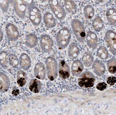Immunohistochemistry-Paraffin: BPTF/FALZ Antibody [NBP1-84756]