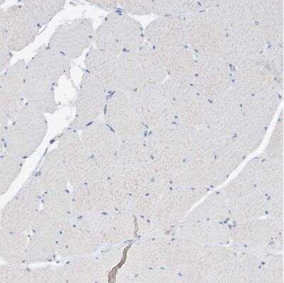 Immunohistochemistry-Paraffin: BPTF/FALZ Antibody [NBP1-84756]