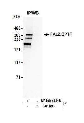 Immunoprecipitation: BPTF/FALZ Antibody [NB100-41418]