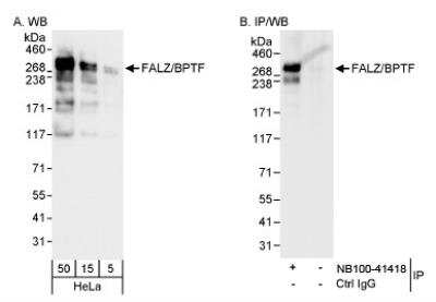 Western Blot: BPTF/FALZ Antibody [NB100-41418]