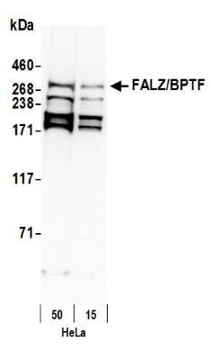Western Blot: BPTF/FALZ Antibody [NB100-41418]