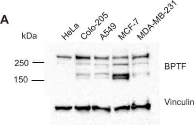 Western Blot: BPTF/FALZ Antibody [NB100-41418]