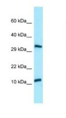 Western Blot: BPY2 Antibody [NBP1-98290]