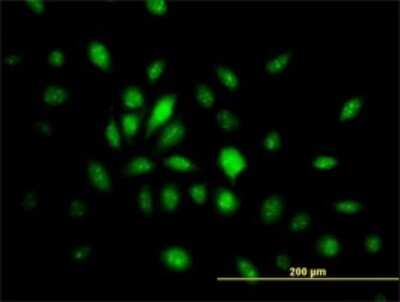 Immunocytochemistry/ Immunofluorescence: BRAF35 Antibody (1F6) [H00010362-M01]