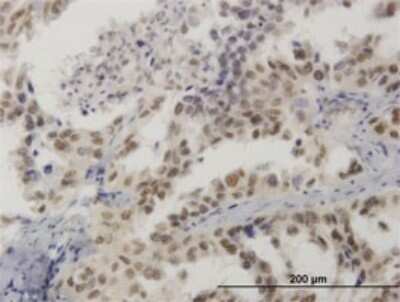 Immunohistochemistry-Paraffin: BRAF35 Antibody (1F6) [H00010362-M01]