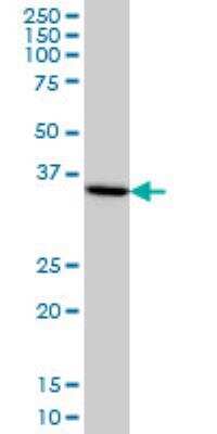 Western Blot: BRAF35 Antibody (1F6) [H00010362-M01]