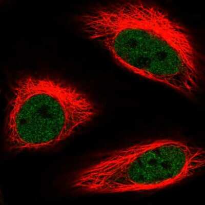 Immunocytochemistry/ Immunofluorescence: BRAF35 Antibody [NBP2-58321]