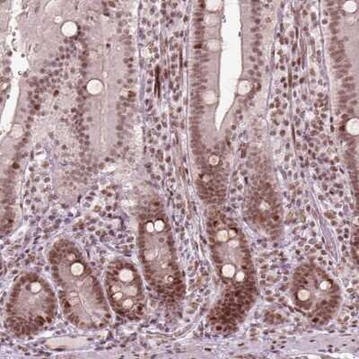 Immunohistochemistry: BRAF35 Antibody [NBP2-49621]