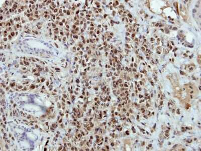 Immunohistochemistry-Paraffin: BRAF35 Antibody [NBP2-15608]