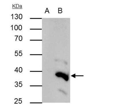 Immunoprecipitation: BRAF35 Antibody [NBP2-15608]