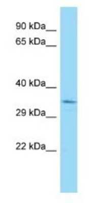 Western Blot: BRAF35 Antibody [NBP1-98256]