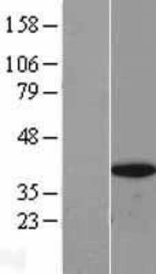 Western Blot: BRAF35 Overexpression Lysate [NBL1-11607]