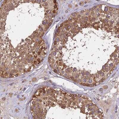 Immunohistochemistry-Paraffin: BRAP Antibody [NBP1-91705]