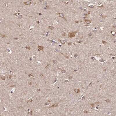 Immunohistochemistry-Paraffin: BRAP Antibody [NBP1-91705]