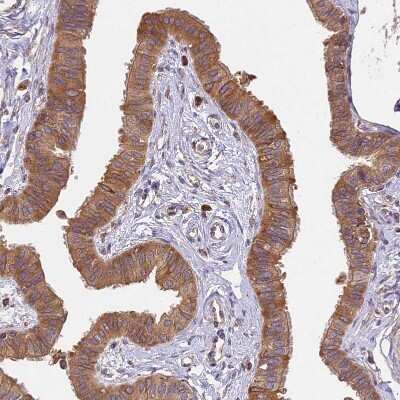 Immunohistochemistry-Paraffin: BRAP Antibody [NBP1-91705]