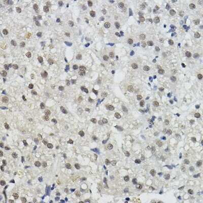 Immunohistochemistry-Paraffin: BRAP Antibody - Azide and BSA Free [NBP2-92871]