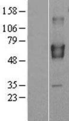 Western Blot: BRAP Overexpression Lysate [NBL1-08022]