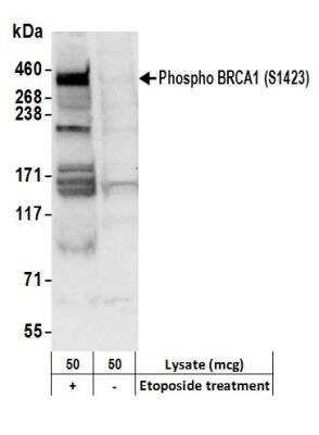 Western Blot: BRCA1 [p Ser1423] Antibody [NB100-226]