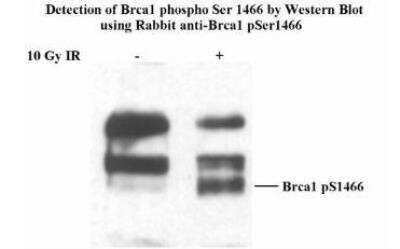 Western Blot: BRCA1 [p Ser1466] Antibody [NB100-228]