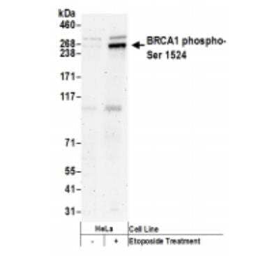 Western Blot: BRCA1 [p Ser1524] Antibody [NB100-200]