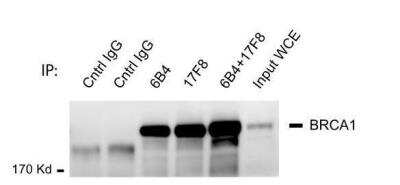 Immunoprecipitation: BRCA1 Antibody (17F8) [NBP1-41185]